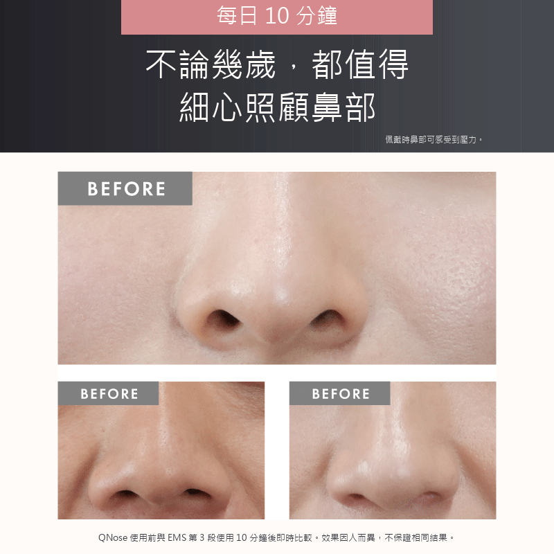 QNose 鼻部專用 EMS 美容儀