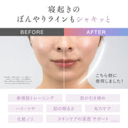 水冷EMS 刮痧美容儀