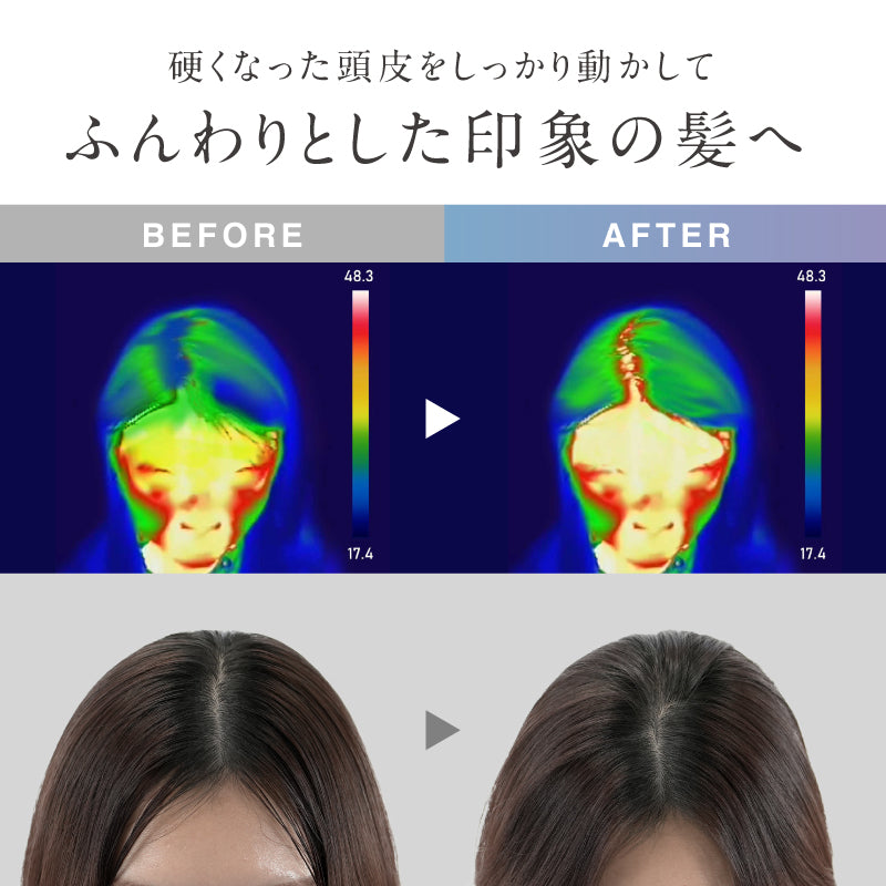NIPLUX HEAD SPA PREMIUM EMS 頭皮及身體護理儀